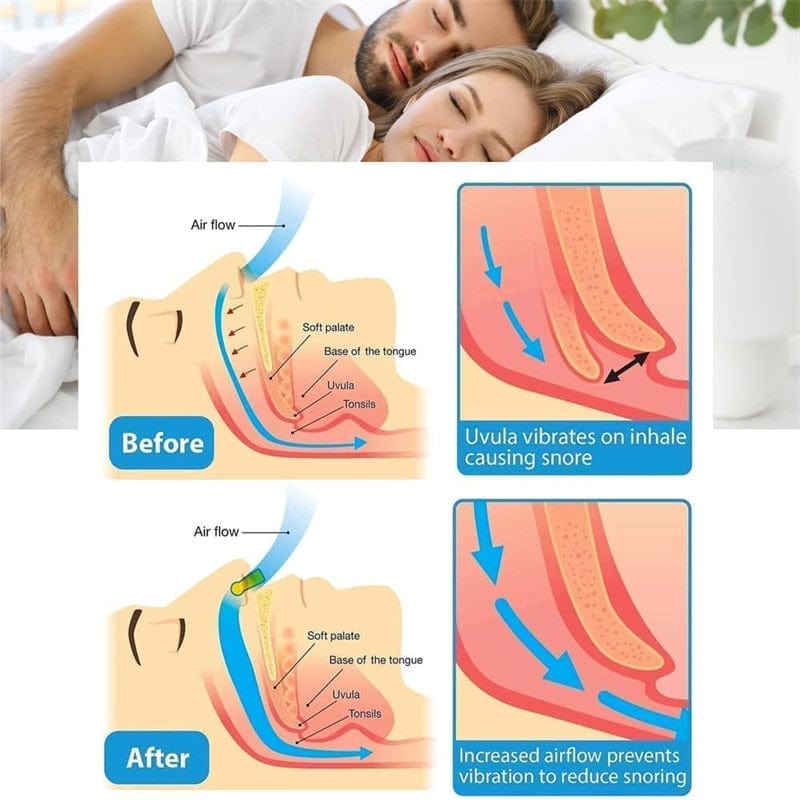Night time Breathing Aid Sleep Comfort Nose Clips Health
